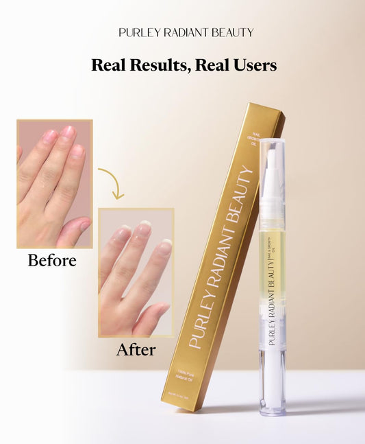 Nail Growth Oil – Natural Cuticle Serum for Stronger Nails & Healthy Growth | Jojoba, Castor, Coconut & Argan Oils | Prevents Breakage, Peeling & Brittleness (3Ml)