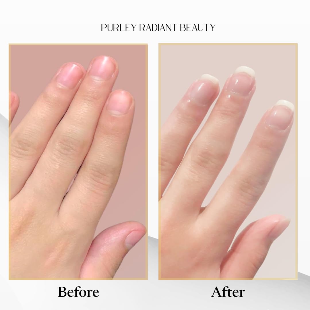Nail Growth Oil – Natural Cuticle Serum for Stronger Nails & Healthy Growth | Jojoba, Castor, Coconut & Argan Oils | Prevents Breakage, Peeling & Brittleness (3Ml)