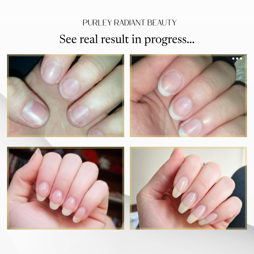 Nail Growth Oil – Natural Cuticle Serum for Stronger Nails & Healthy Growth | Jojoba, Castor, Coconut & Argan Oils | Prevents Breakage, Peeling & Brittleness (3Ml)